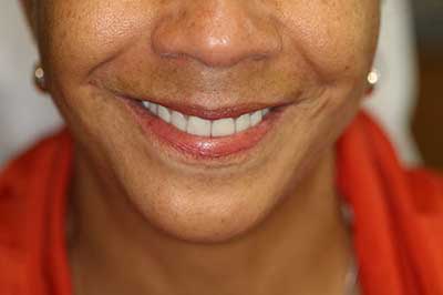 Dentist in Jamesville NY