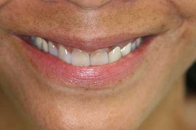 Jamesville NY Best Dentist