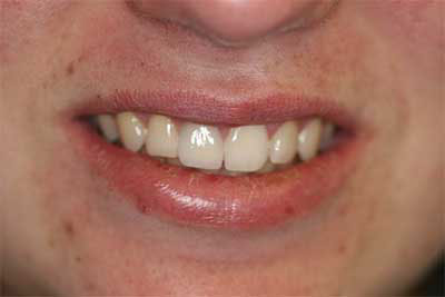 Jamesville NY Best Dentist