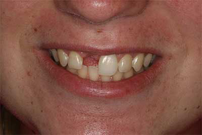 Cosmetic Dentist in Jamesville NY