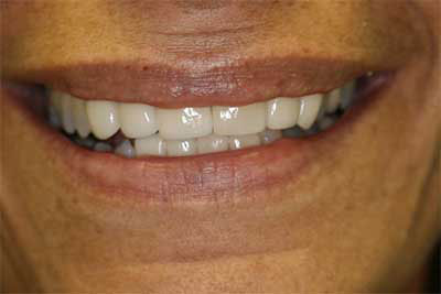 Jamesville NY Best Dentist