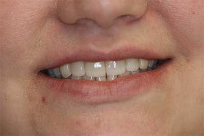 Cosmetic Dentist in Jamesville NY