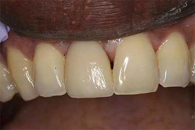 Cosmetic Dentist in Jamesville NY