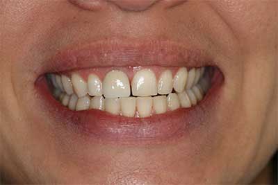 Jamesville NY Best Dentist