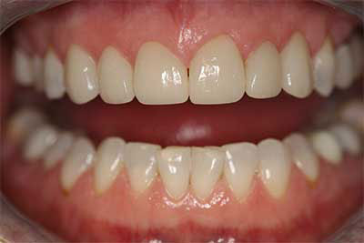 Dentist in Jamesville NY