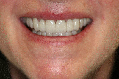 Dentist in Jamesville NY